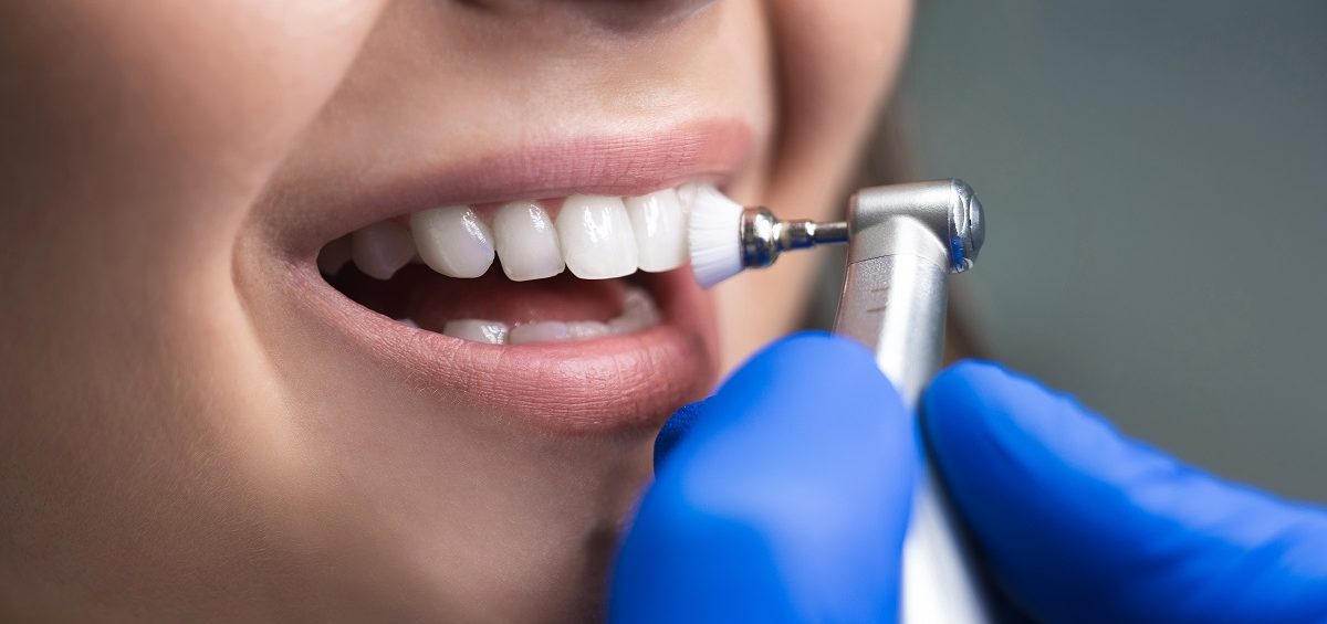 Possible Risks of Not Getting a Teeth Cleaning