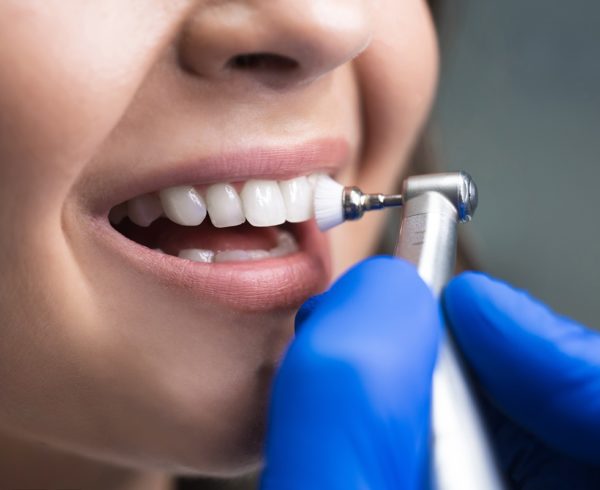 Possible Risks of Not Getting a Teeth Cleaning