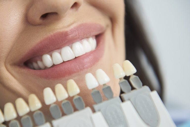How much does teeth whitening cost with dental insurance