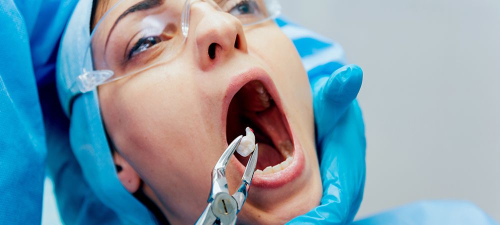 Wisdom Teeth Removal Cost in Toronto